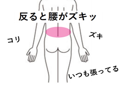 みんなの症例【腰痛】❝身体を反ると腰が痛む❞