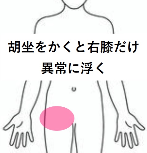 みんなの症例【股関節痛】❝右の股関節だけが膝を上げたりすると痛い❞