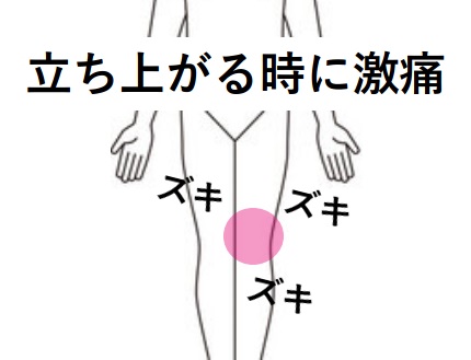 みんなの症例【膝痛】❝しゃがんだ状態から立ち上がるときに激痛❞