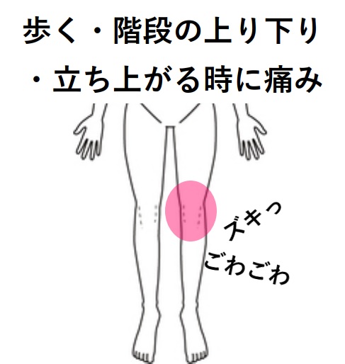 みんなの症例【膝痛】❝膝が痛く水も溜まって歩くのが辛い❞