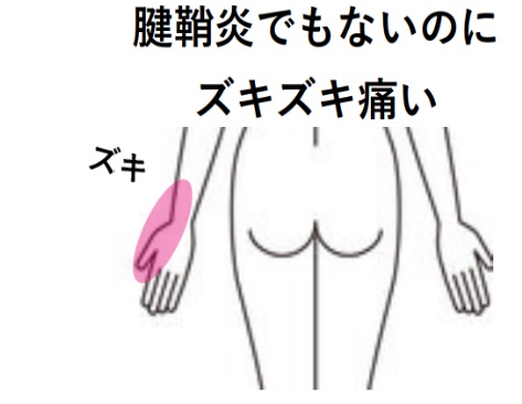 みんなの症例【手痛（神経痛）】❝寝ている時に親指側がズキズキ❞