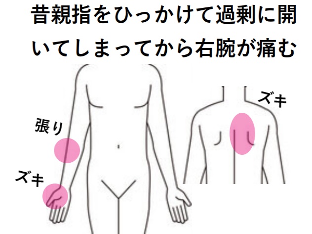 みんなの症例【手痛】❝昔の古傷で親指がズキズキ痛む❞