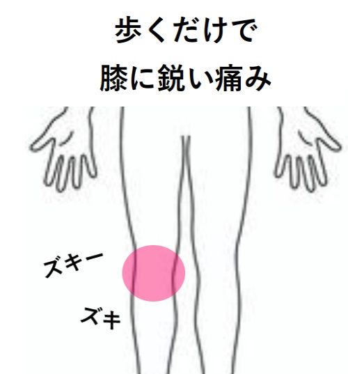 みんなの症例【膝痛（変形性膝関節症）】❝歩くだけで膝が痛く、動かすと骨がこすれているような音が鳴る❞